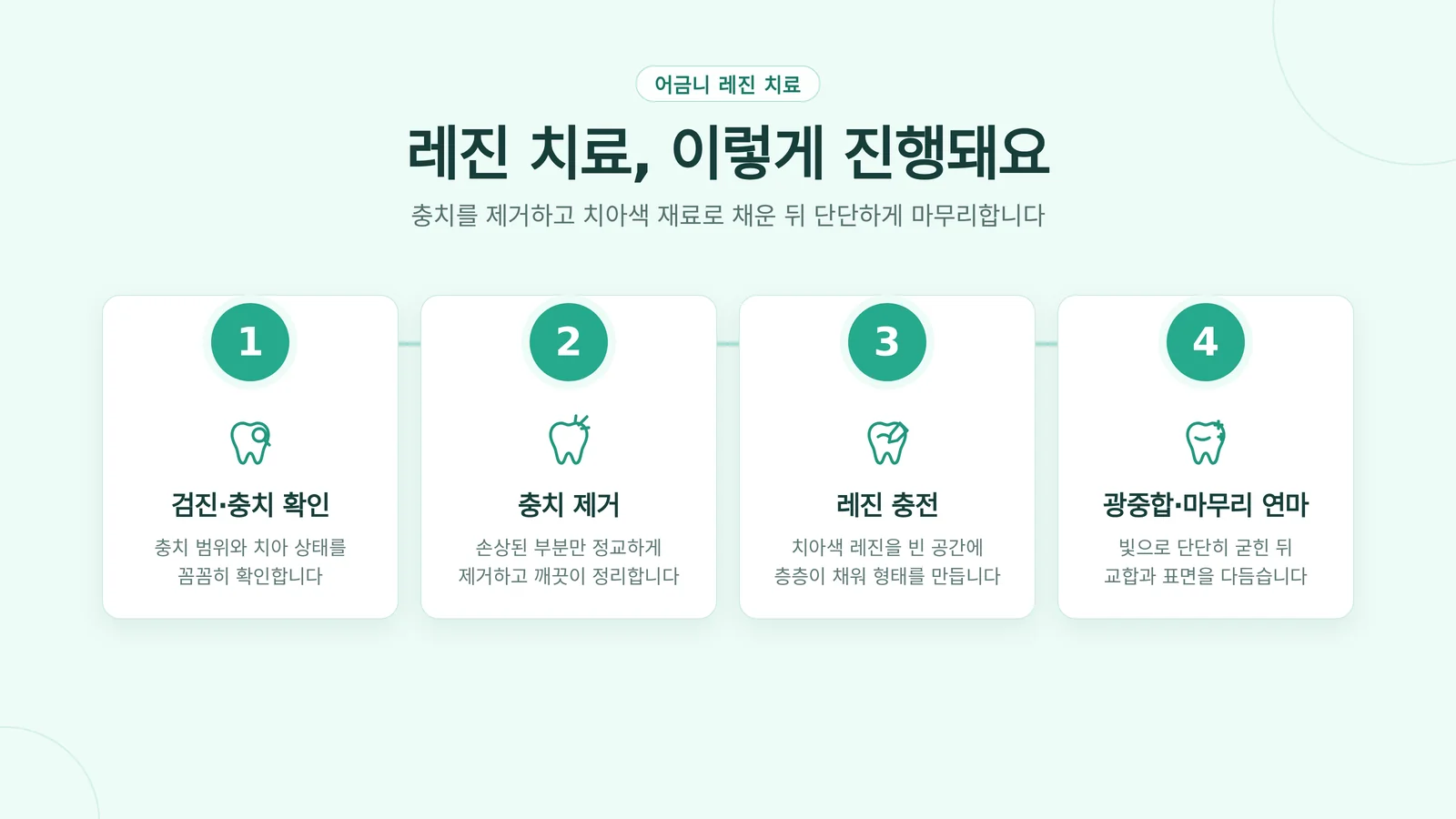 레진 충전 치료 절차 4단계 인포그래픽